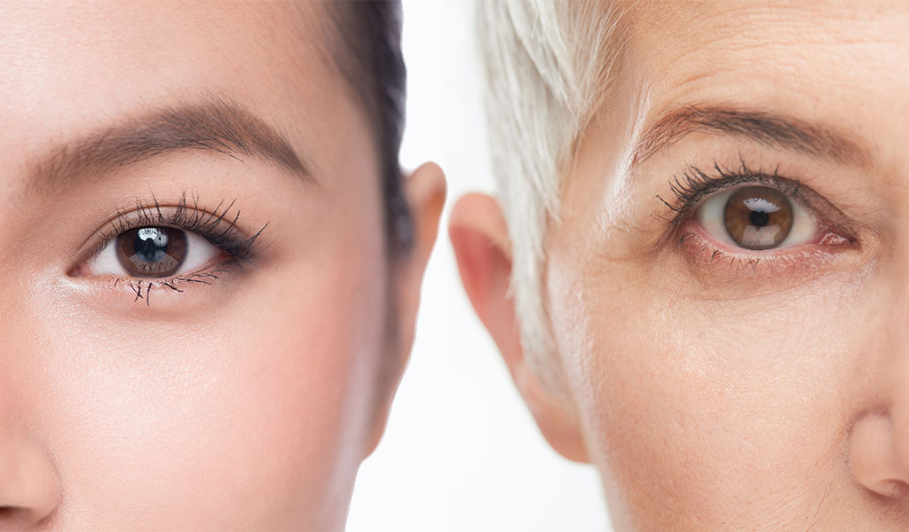 2 women's eyes - young on left and old on right
